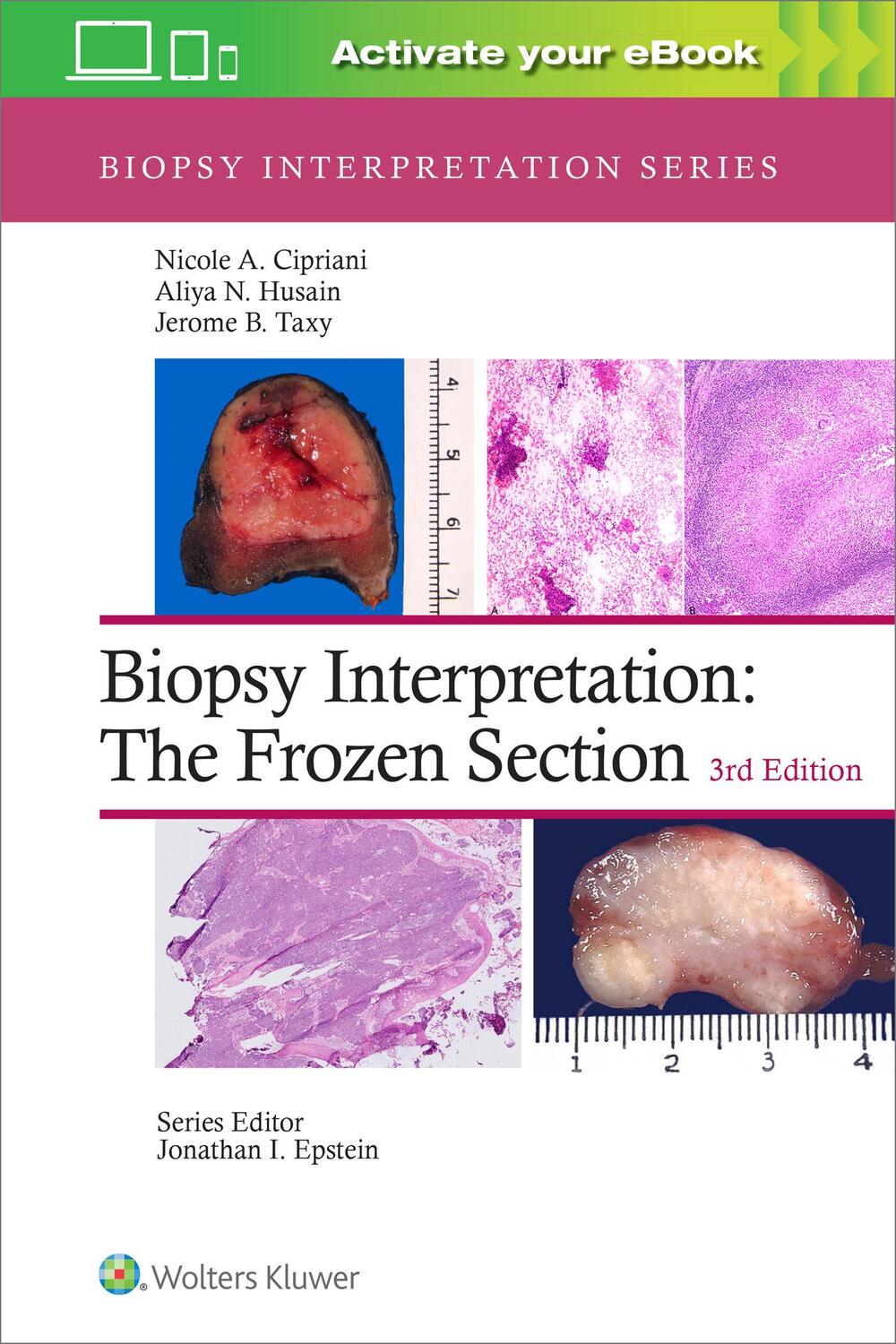Cover: 9781975170073 | Biopsy Interpretation: The Frozen Section | Nicole A. Cipriani (u. a.)