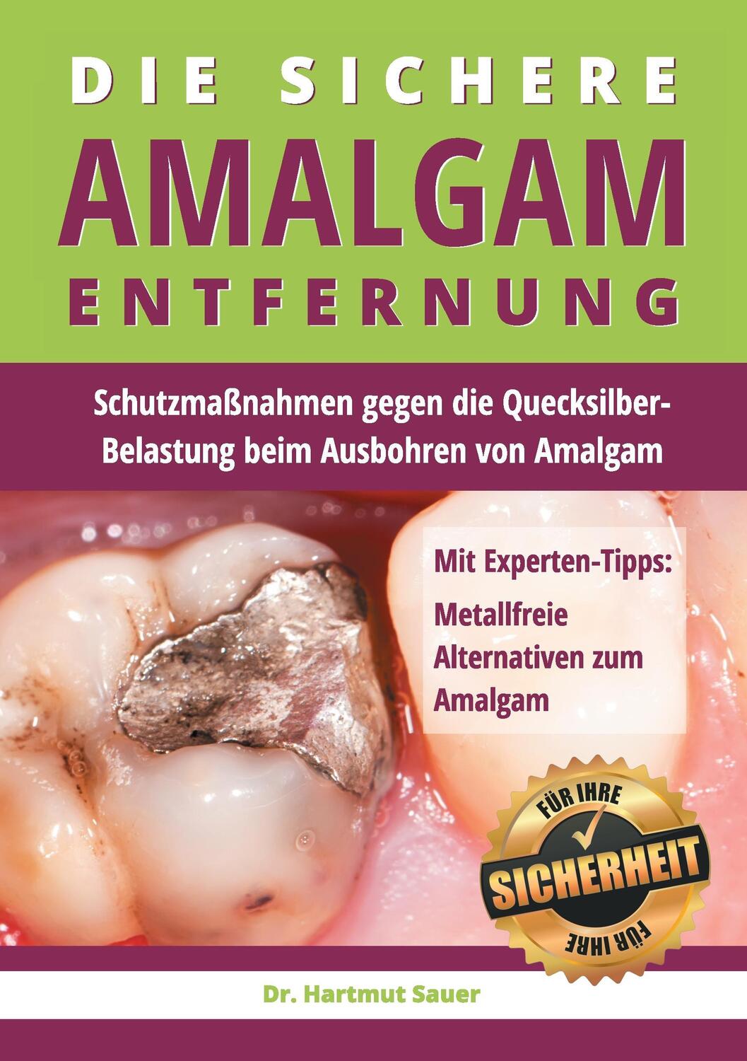Cover: 9783735763242 | Die sichere Amalgam-Entfernung | Hartmut Sauer | Taschenbuch