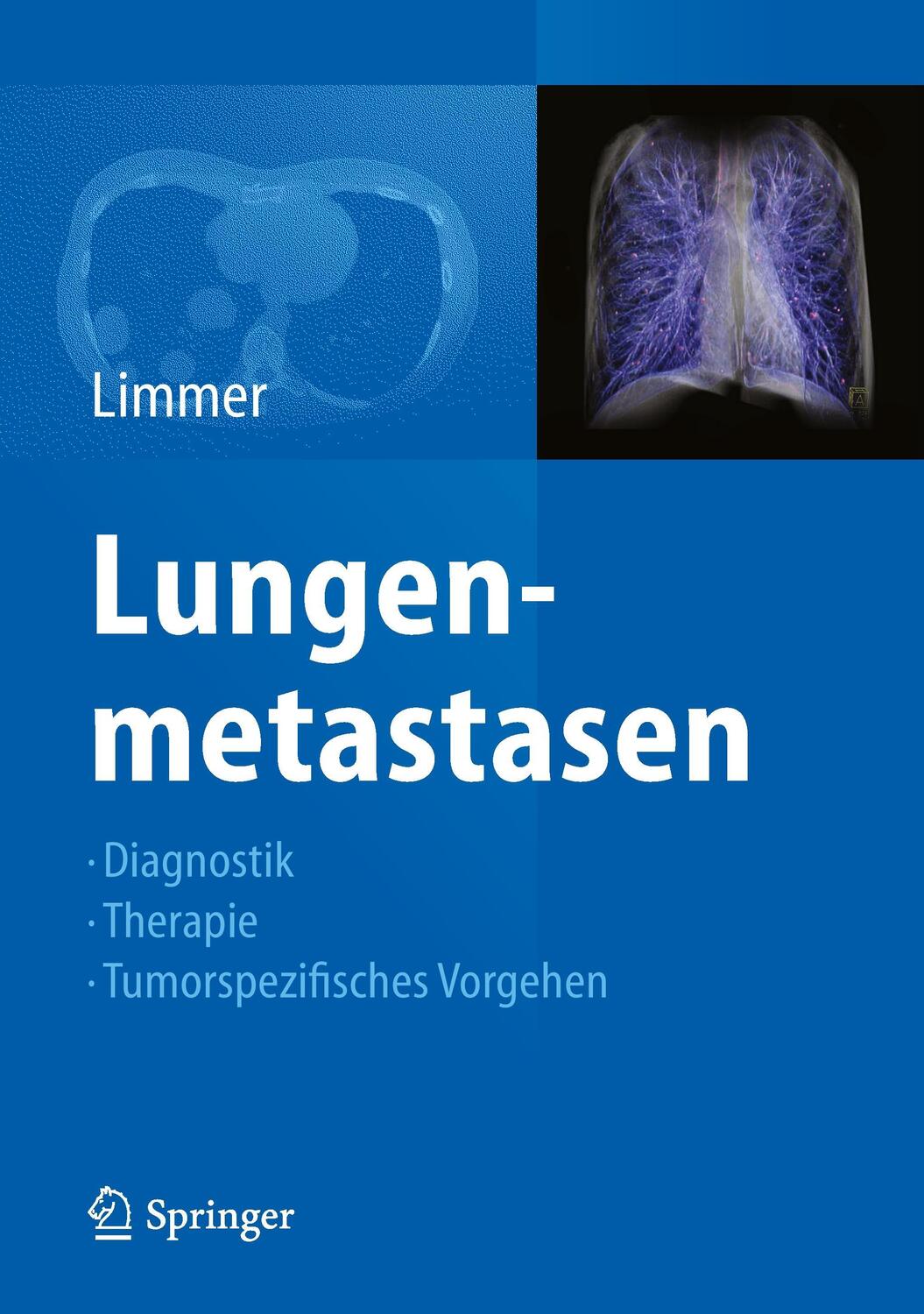 Cover: 9783642329814 | Lungenmetastasen | Diagnostik - Therapie - Tumorspezifisches Vorgehen