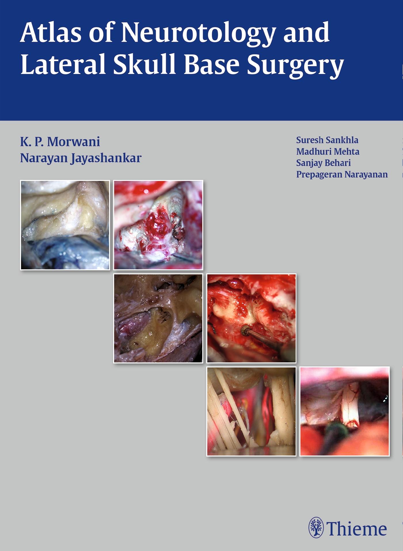 Cover: 9789382076933 | Atlas of Neurotology and Lateral Skull Base Surgery | Buch | 260 S.