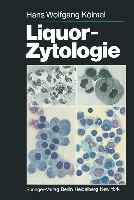 Cover: 9783642964596 | Liquor-Zytologie | H. W. Kölmel | Taschenbuch | Paperback | X | 2012