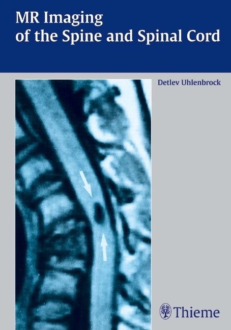 Cover: 9783131309419 | MR Imaging of the Spine and Spinal Cord | Detlev Uhlenbrock | Buch