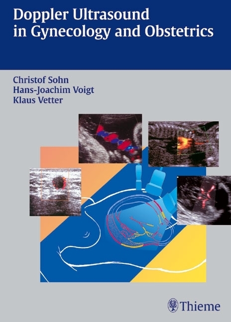 Cover: 9783131355911 | Doppler Ultrasound in Gynecology and Obstretics | Sohn (u. a.) | Buch