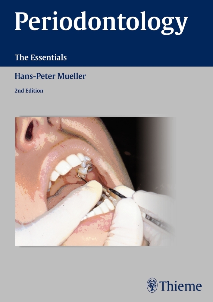 Cover: 9783131383723 | Periodontology | The Essentials | Hans-Peter Müller | Buch | Englisch
