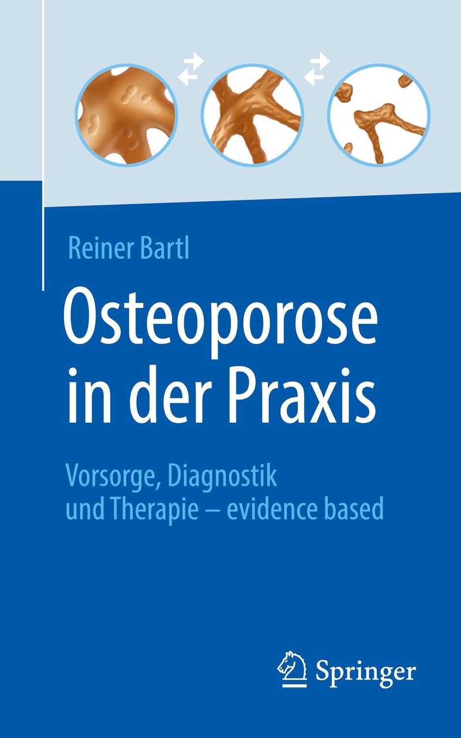 Cover: 9783662642061 | Osteoporose in der Praxis | Reiner Bartl | Taschenbuch | 2022
