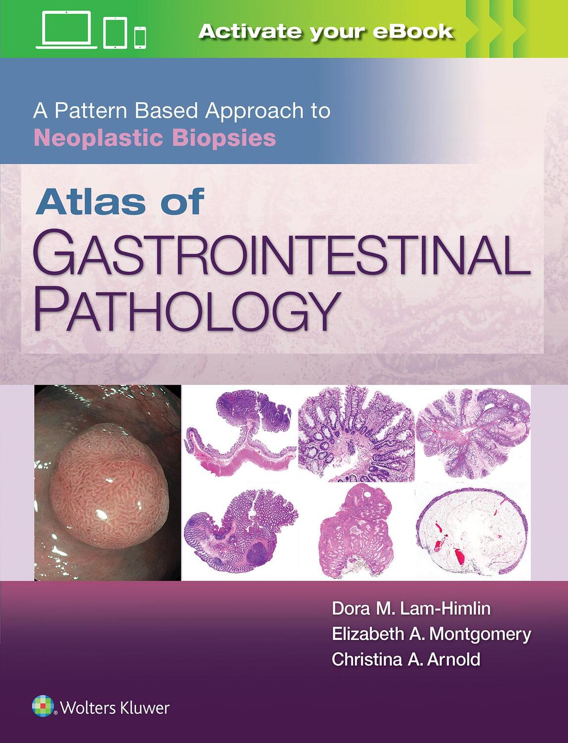 Cover: 9781496367549 | Atlas of Gastrointestinal Pathology: A Pattern Based Approach to...