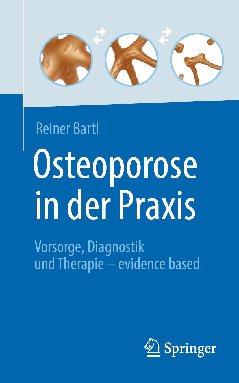 Cover: 9783662642061 | Osteoporose in der Praxis | Reiner Bartl | Taschenbuch | Paperback