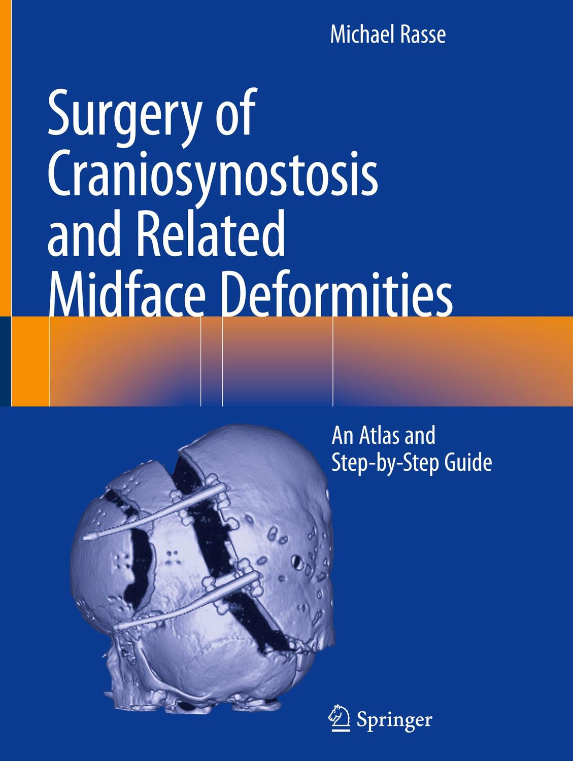 Cover: 9783031491016 | Surgery of Craniosynostosis and Related Midface Deformities | Rasse