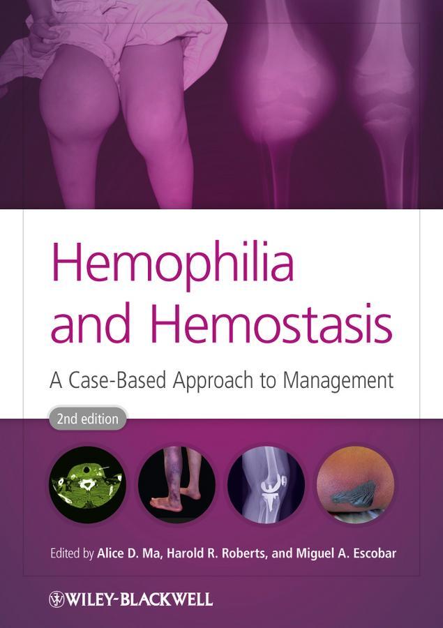 Cover: 9780470659762 | Hemophilia and Hemostasis | A Case-Based Approach to Management | Buch