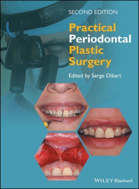 Cover: 9781118360651 | Practical Periodontal Plastic Surgery | Serge Dibart | Buch | 176 S.