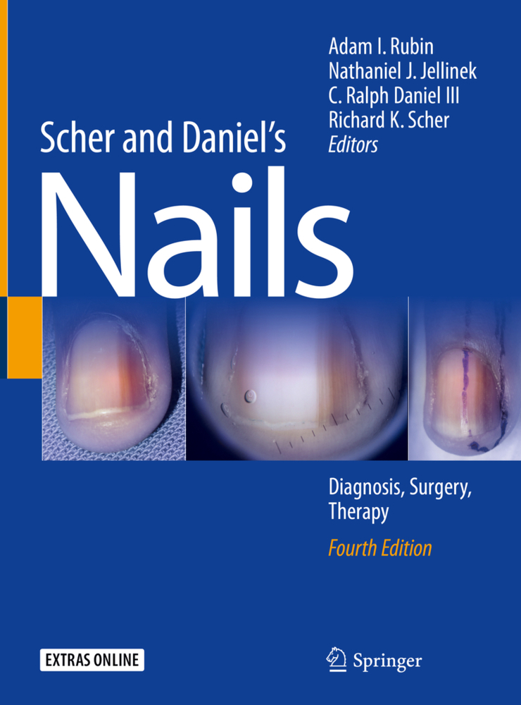 Cover: 9783319656472 | Scher and Daniel's Nails | Adam I. Rubin (u. a.) | Buch | xx | 2018