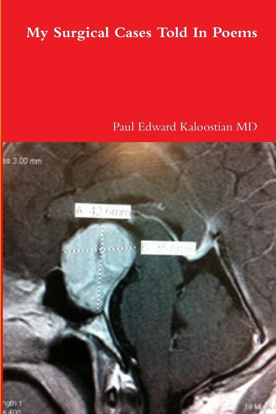 Cover: 9781105650680 | My Surgical Cases Told In Poems | Paul Edward Kaloostian MD | Buch