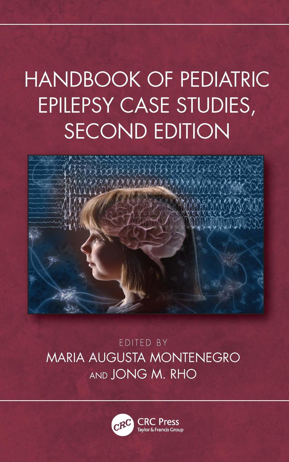 Cover: 9781032283548 | Handbook of Pediatric Epilepsy Case Studies, Second Edition | Buch