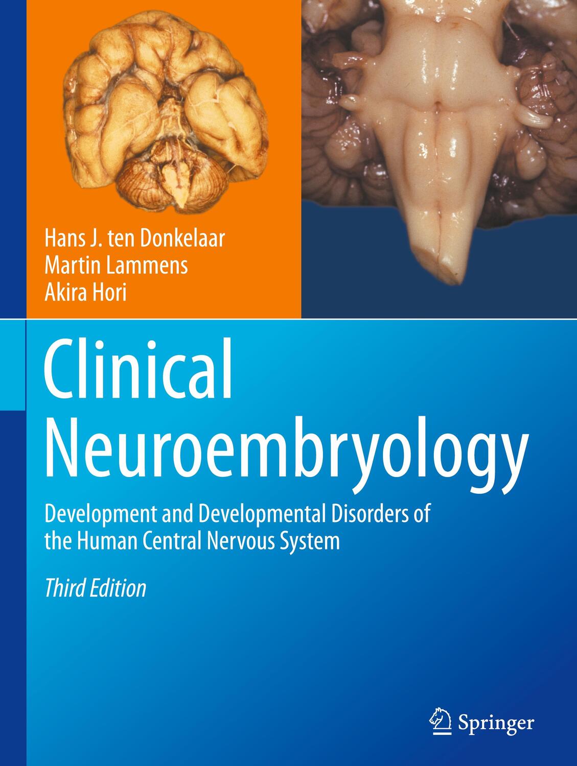 Cover: 9783031260971 | Clinical Neuroembryology | Akira Hori (u. a.) | Buch | xvi | Englisch