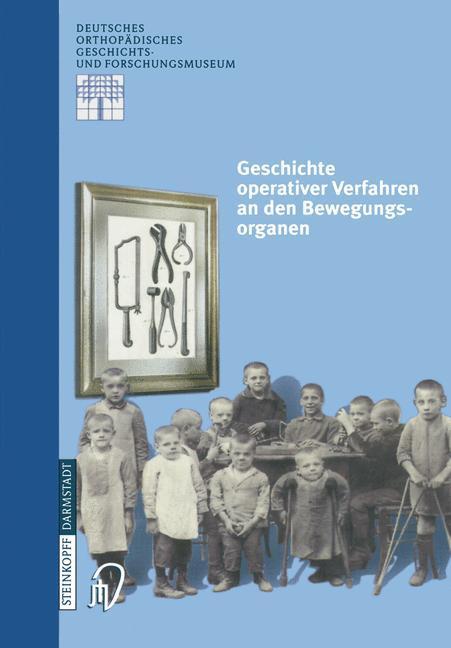 Cover: 9783798512313 | Geschichte operativer Verfahren an den Bewegungsorganen | Taschenbuch