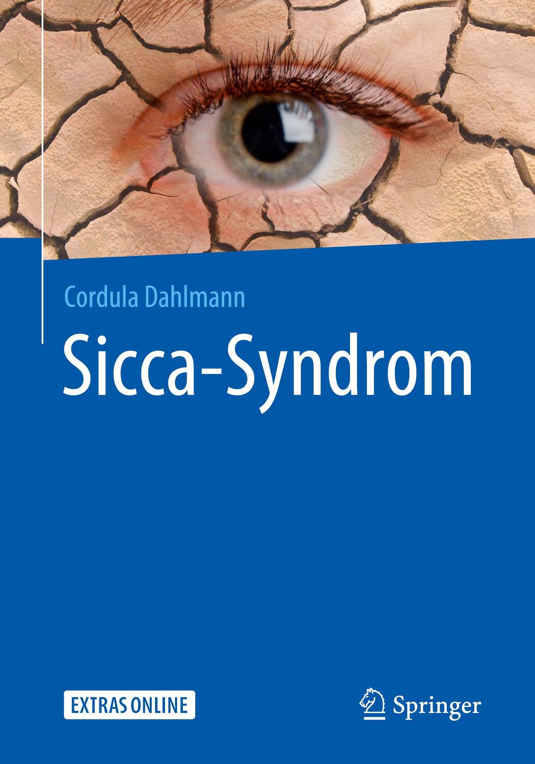Cover: 9783662564080 | Sicca-Syndrom | Cordula Dahlmann | Taschenbuch | Deutsch | 2020