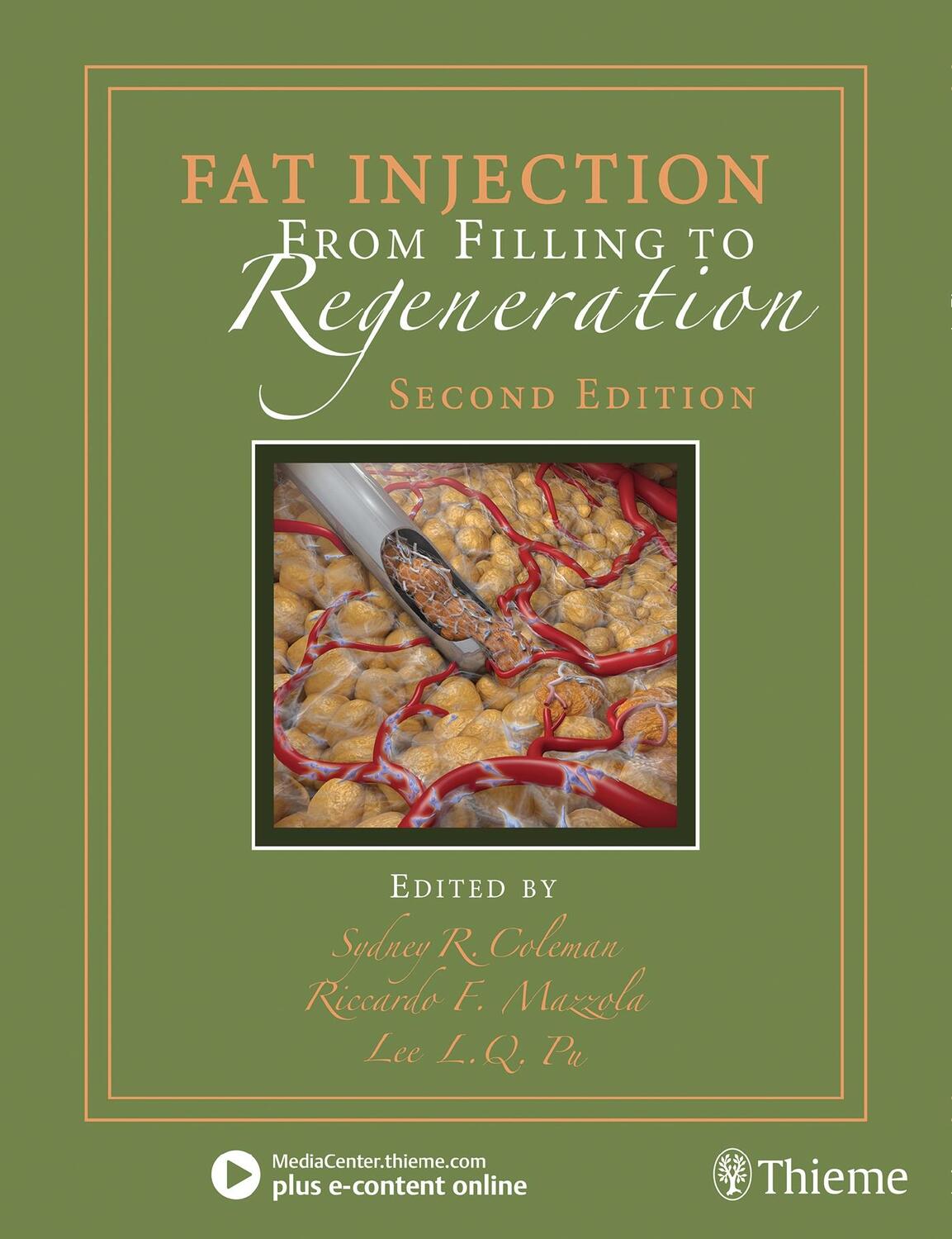 Cover: 9781626236752 | Fat Injection | From Filling to Regeneration | Coleman (u. a.) | 2017