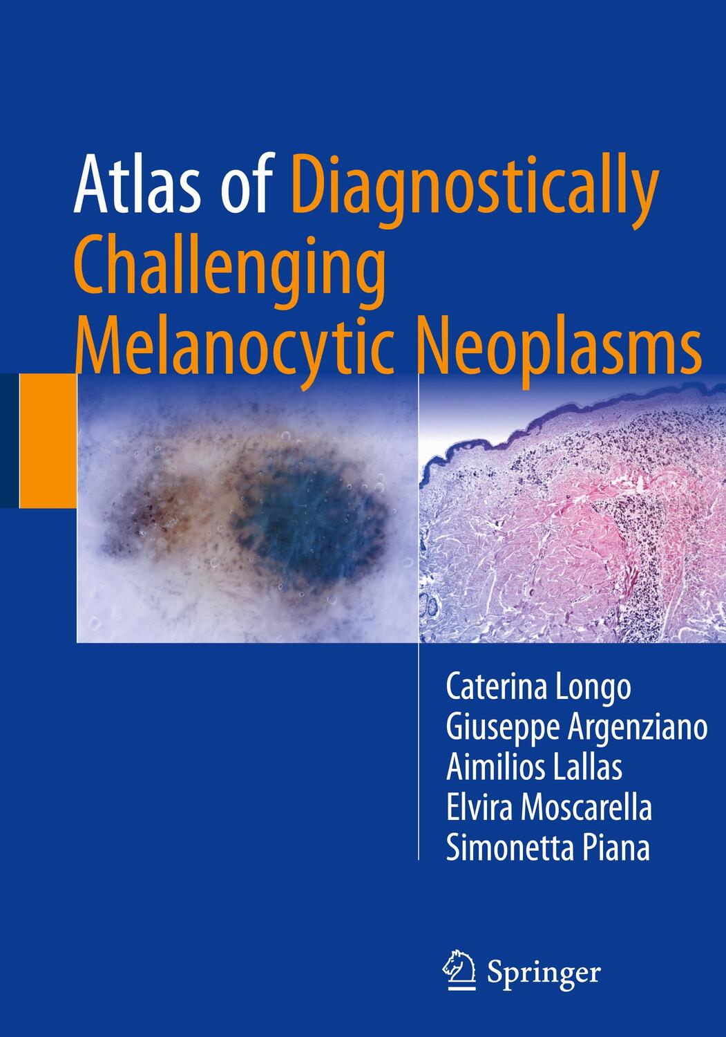 Cover: 9783319486512 | Atlas of Diagnostically Challenging Melanocytic Neoplasms | Buch