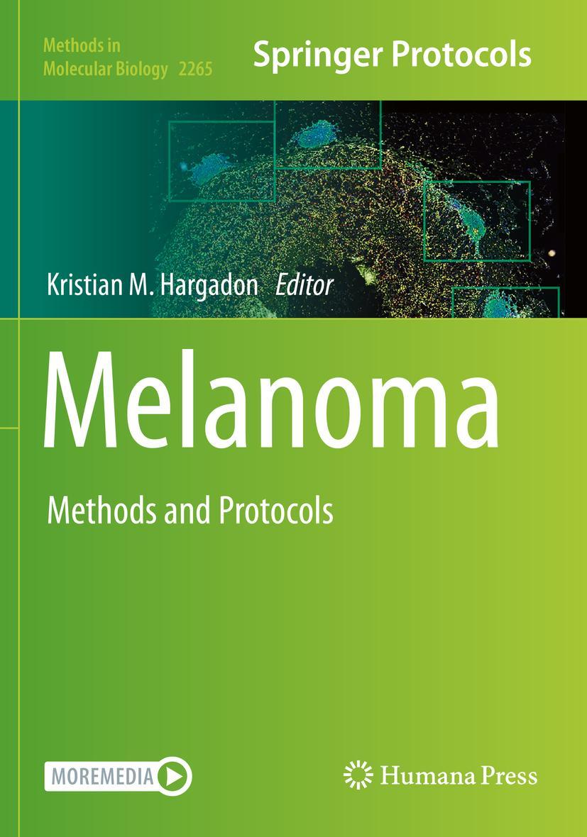 Cover: 9781071612071 | Melanoma | Methods and Protocols | Kristian M. Hargadon | Taschenbuch