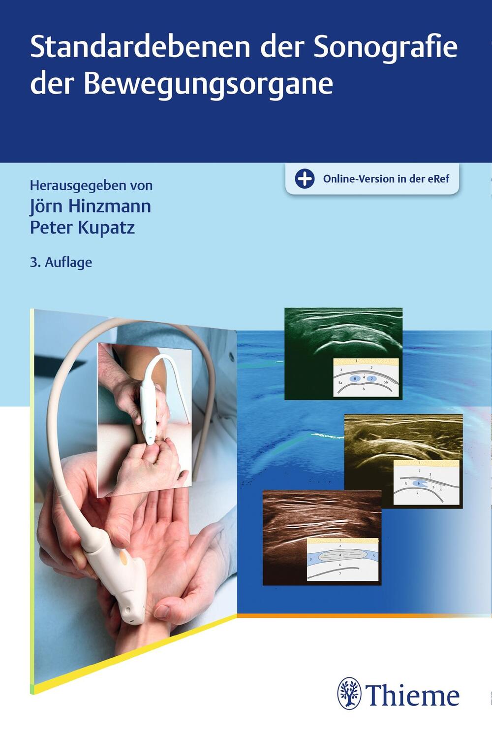 Cover: 9783132432130 | Standardebenen der Sonografie der Bewegungsorgane | Hinzmann (u. a.)