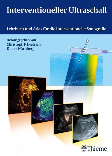 Cover: 9783131311313 | Interventioneller Ultraschall | Christoph Frank Dietrich (u. a.)