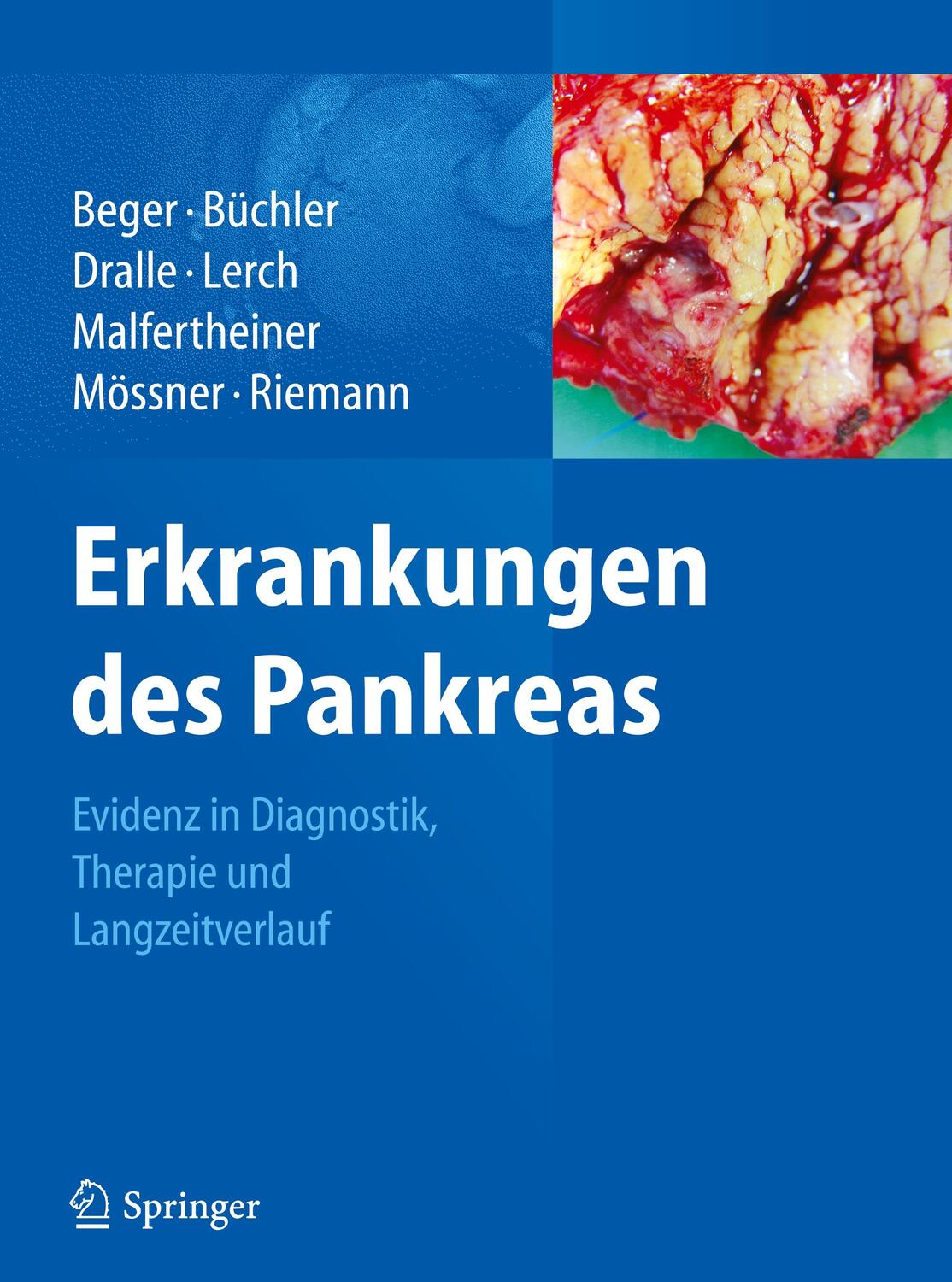 Cover: 9783642379635 | Erkrankungen des Pankreas | Hans G. Beger (u. a.) | Buch | Deutsch