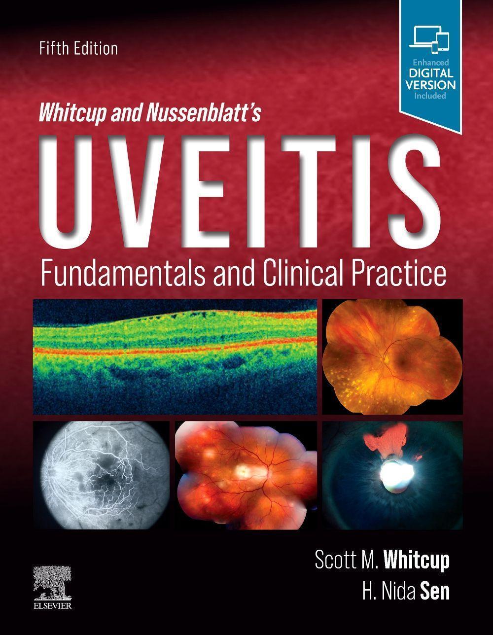 Cover: 9780323480147 | Whitcup and Nussenblatt's Uveitis | Fundamentals and Clinical Practice