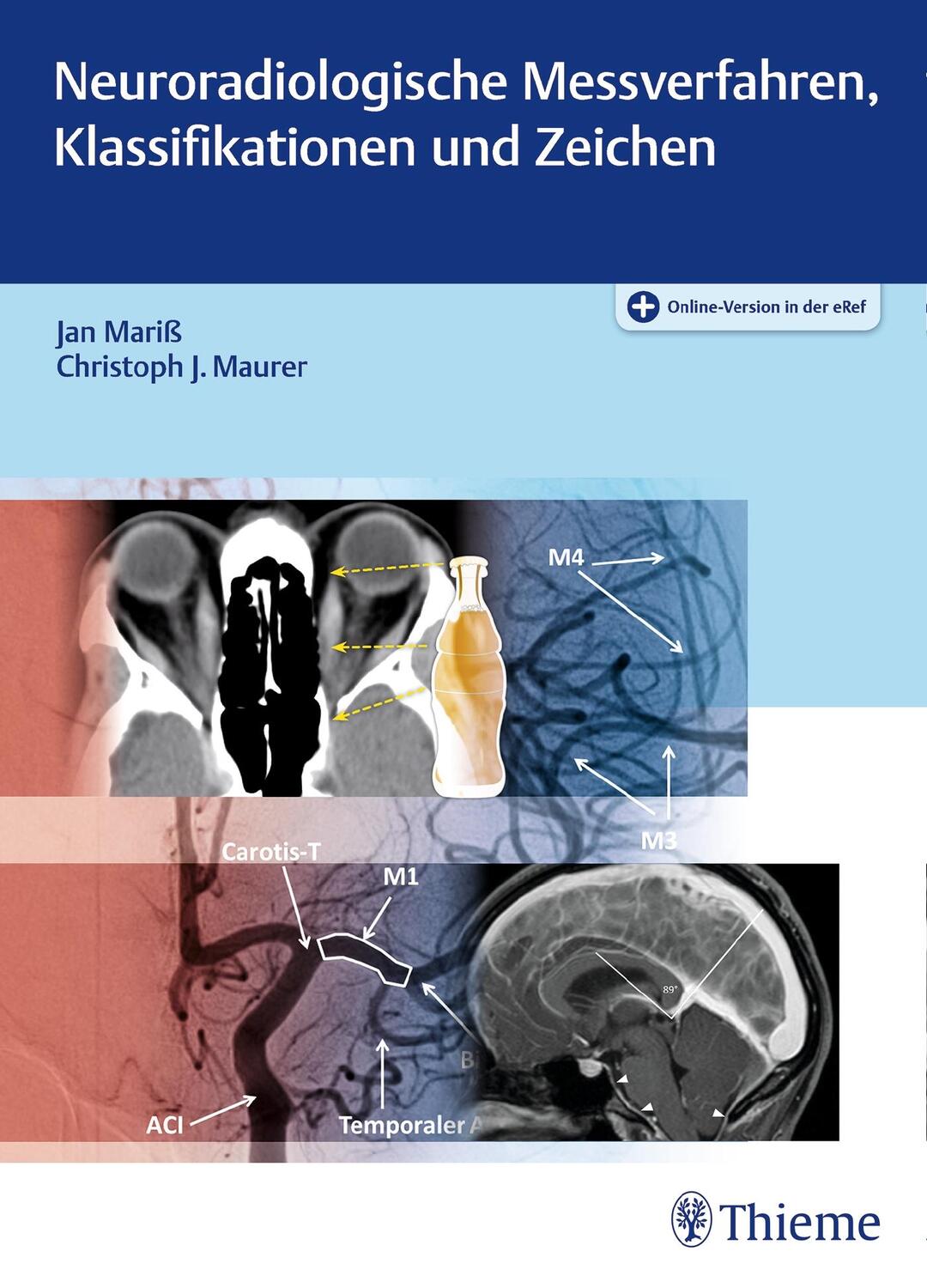Cover: 9783131754417 | Neuroradiologische Messverfahren, Klassifikationen und Zeichen | 2018