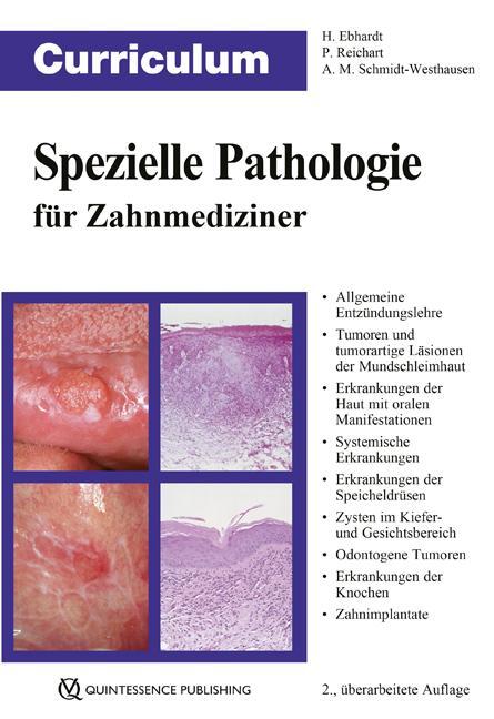 Cover: 9783868673876 | Curriculum Spezielle Pathologie für Zahnmediziner | Ebhardt (u. a.)