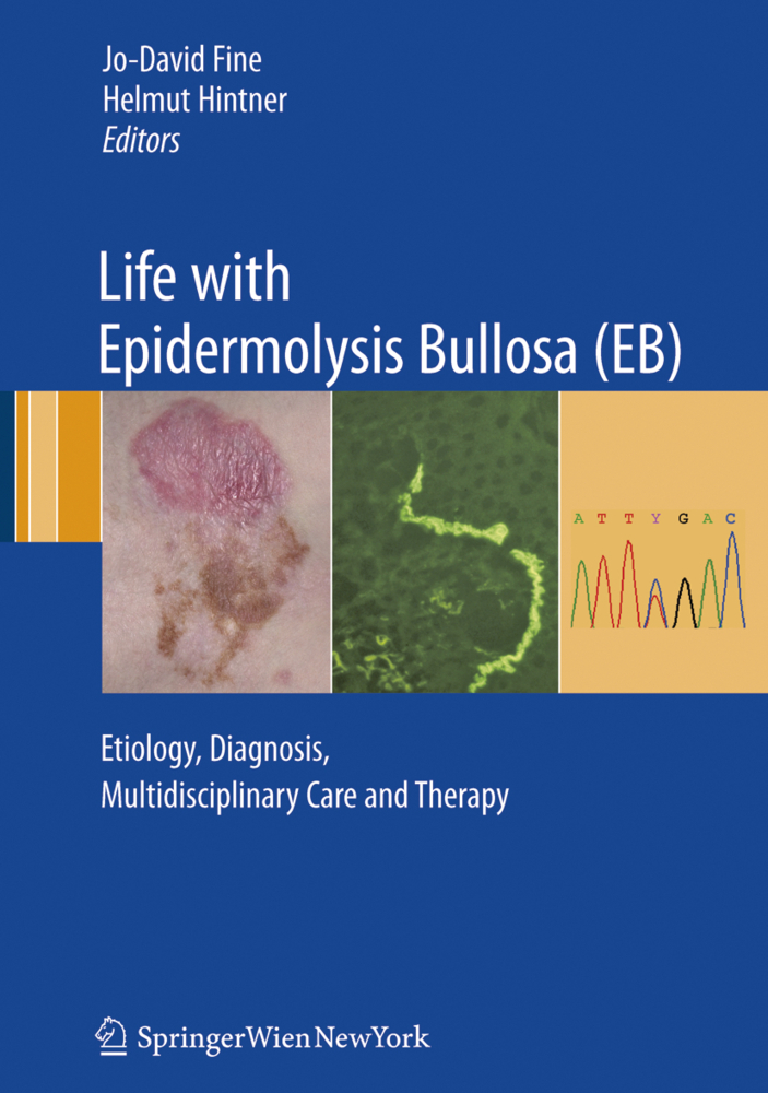 Cover: 9783211999349 | Life with Epidermolysis Bullosa (EB) | Jo-David Fine (u. a.) | Buch