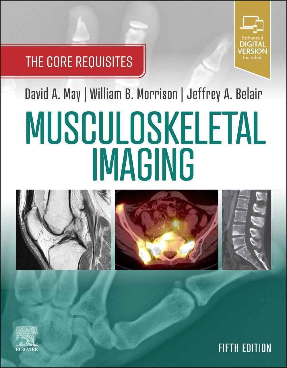 Cover: 9780323680592 | Musculoskeletal Imaging | The Core Requisites | David A. May (u. a.)