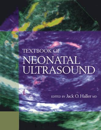 Cover: 9781850709022 | Textbook of Neonatal Ultrasound | J O Haller | Buch | Englisch | 1998