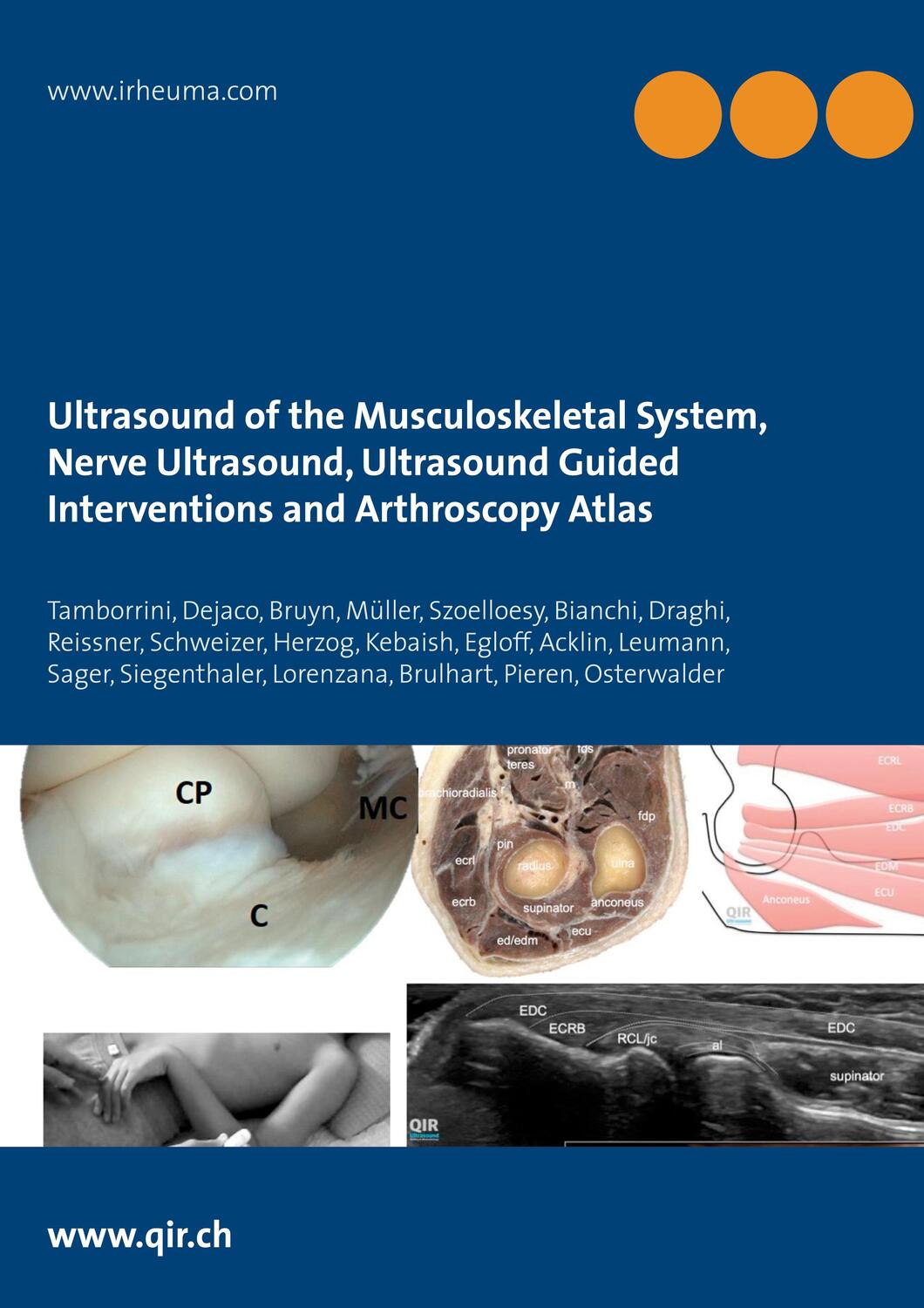 Cover: 9783751998512 | Ultrasound of the Musculoskeletal System, Nerve Ultrasound,...