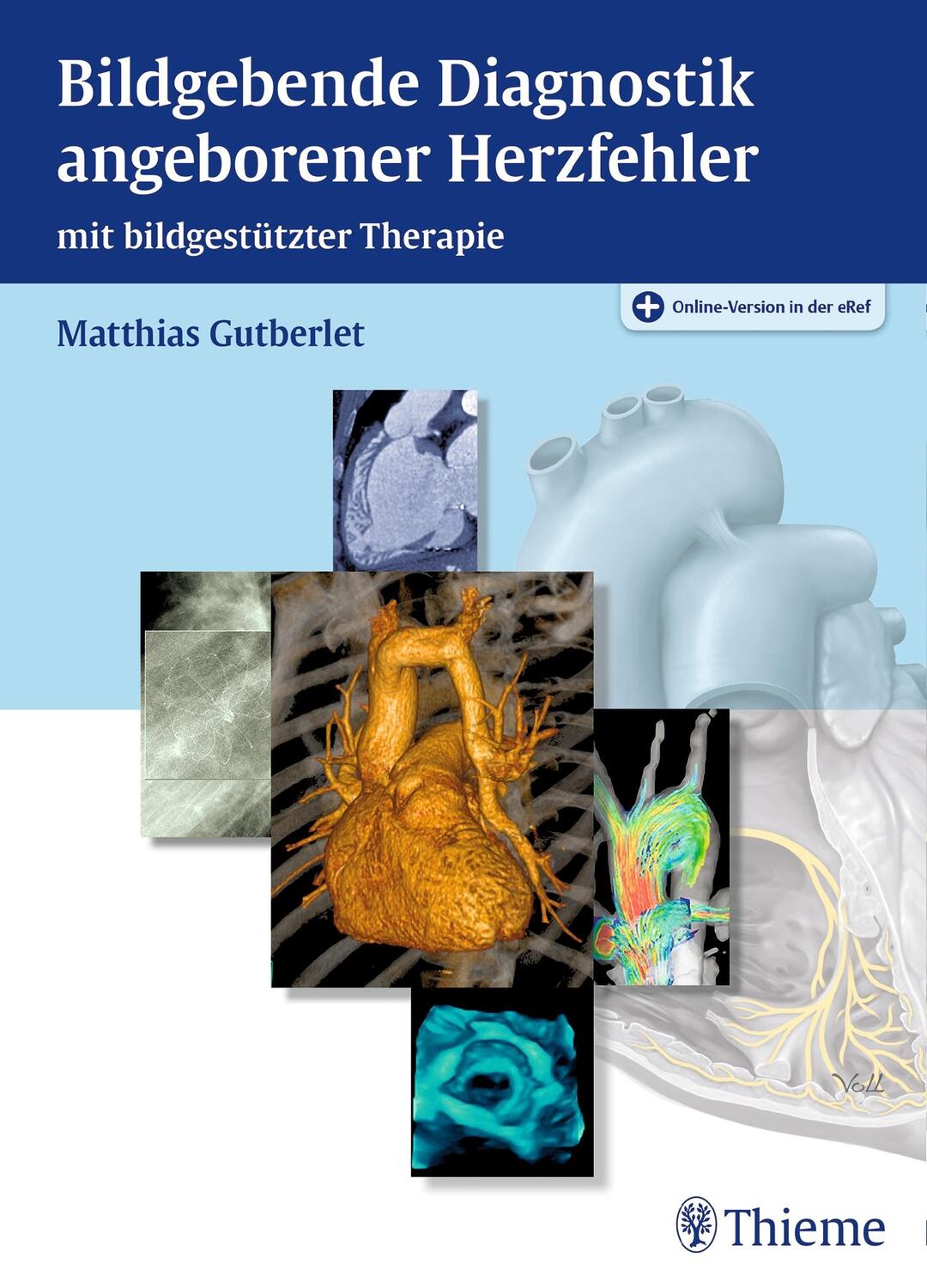 Cover: 9783131460615 | Bildgebende Diagnostik angeborener Herzfehler | Matthias Gutberlet