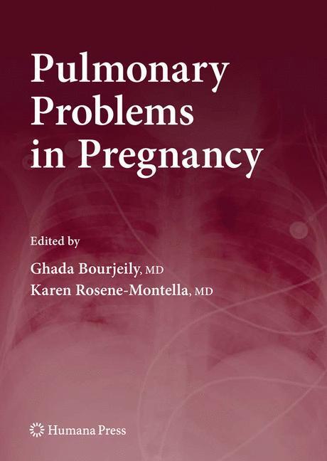 Cover: 9781934115121 | Pulmonary Problems in Pregnancy | Karen Rosene-Montella (u. a.) | Buch