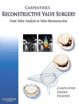 Cover: 9780721691688 | Carpentier's Reconstructive Valve Surgery | Alain Carpentier (u. a.)