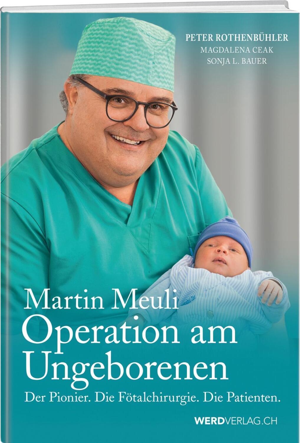 Cover: 9783859328372 | Martin Meuli - Operation am Ungeborenen | Weber Verlag Thun