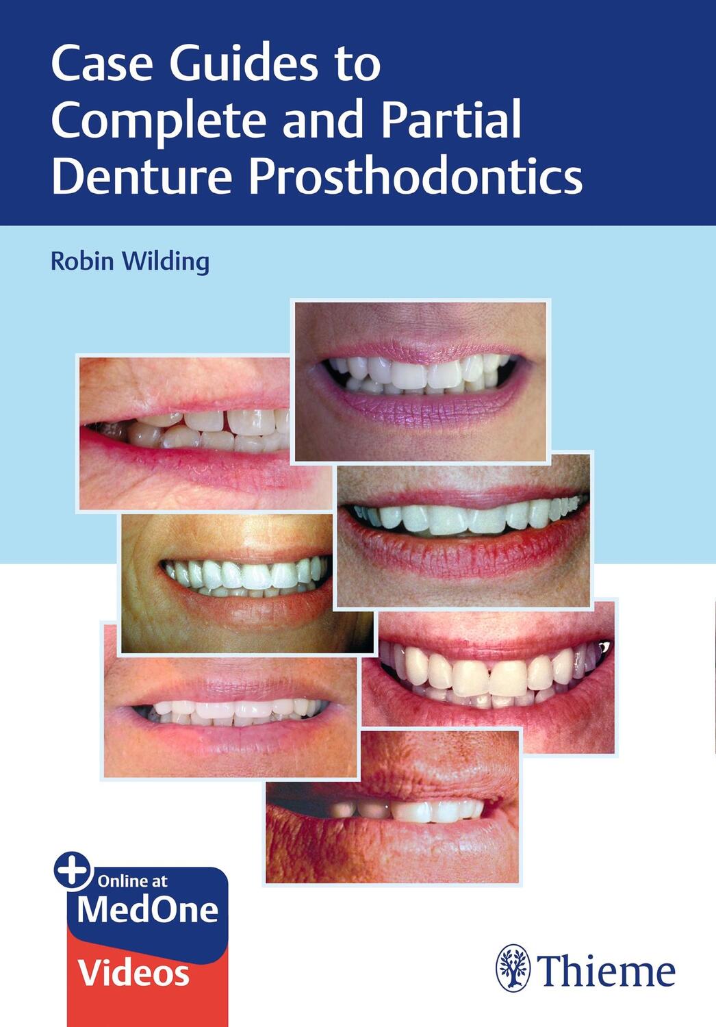 Cover: 9781684201693 | Case Guides to Complete and Partial Denture Prosthodontics | Wilding