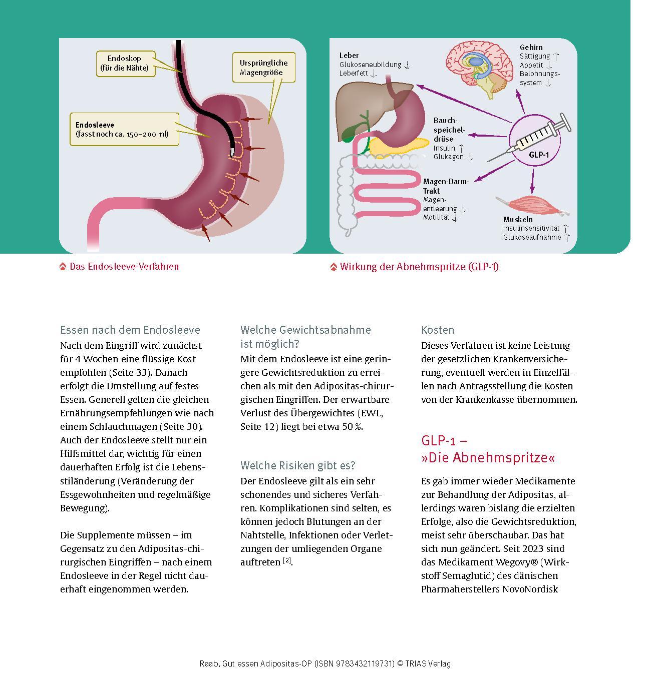 Bild: 9783432119731 | Gut essen Adipositas-OP | Heike Raab | Taschenbuch | Köstlich essen