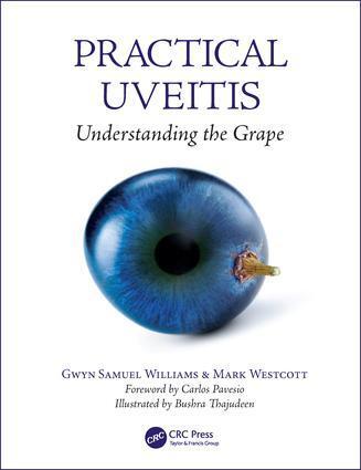 Cover: 9781138035751 | Practical Uveitis | Understanding the Grape | Williams (u. a.) | Buch