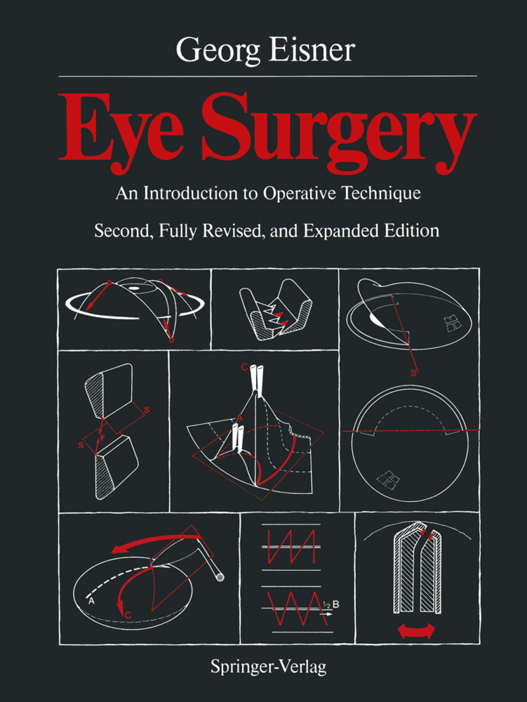 Cover: 9783642718014 | Eye Surgery | An Introduction to Operative Technique | Georg Eisner