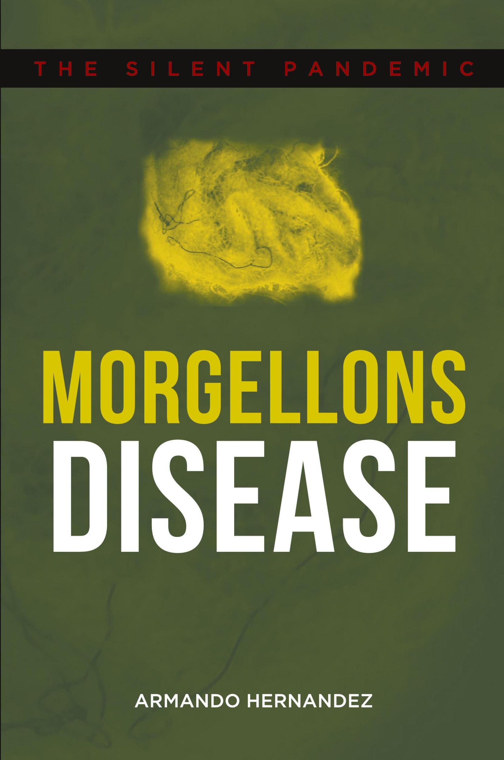 Cover: 9781648010248 | Morgellons Disease | The Silent Pandemic | Armando Hernandez | Buch