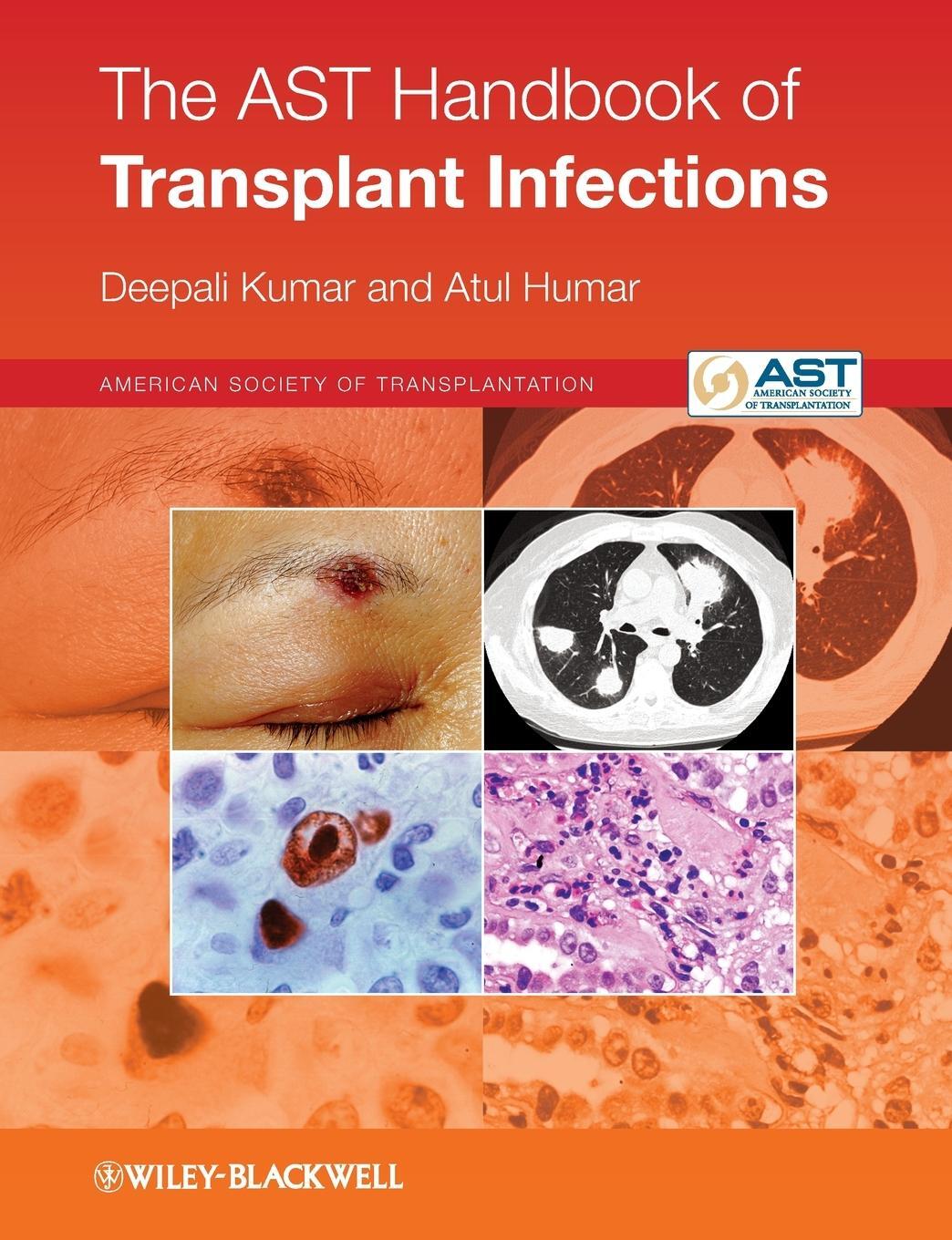Cover: 9780470658277 | The Ast Handbook of Transplant Infections | Deepali Kumar (u. a.)