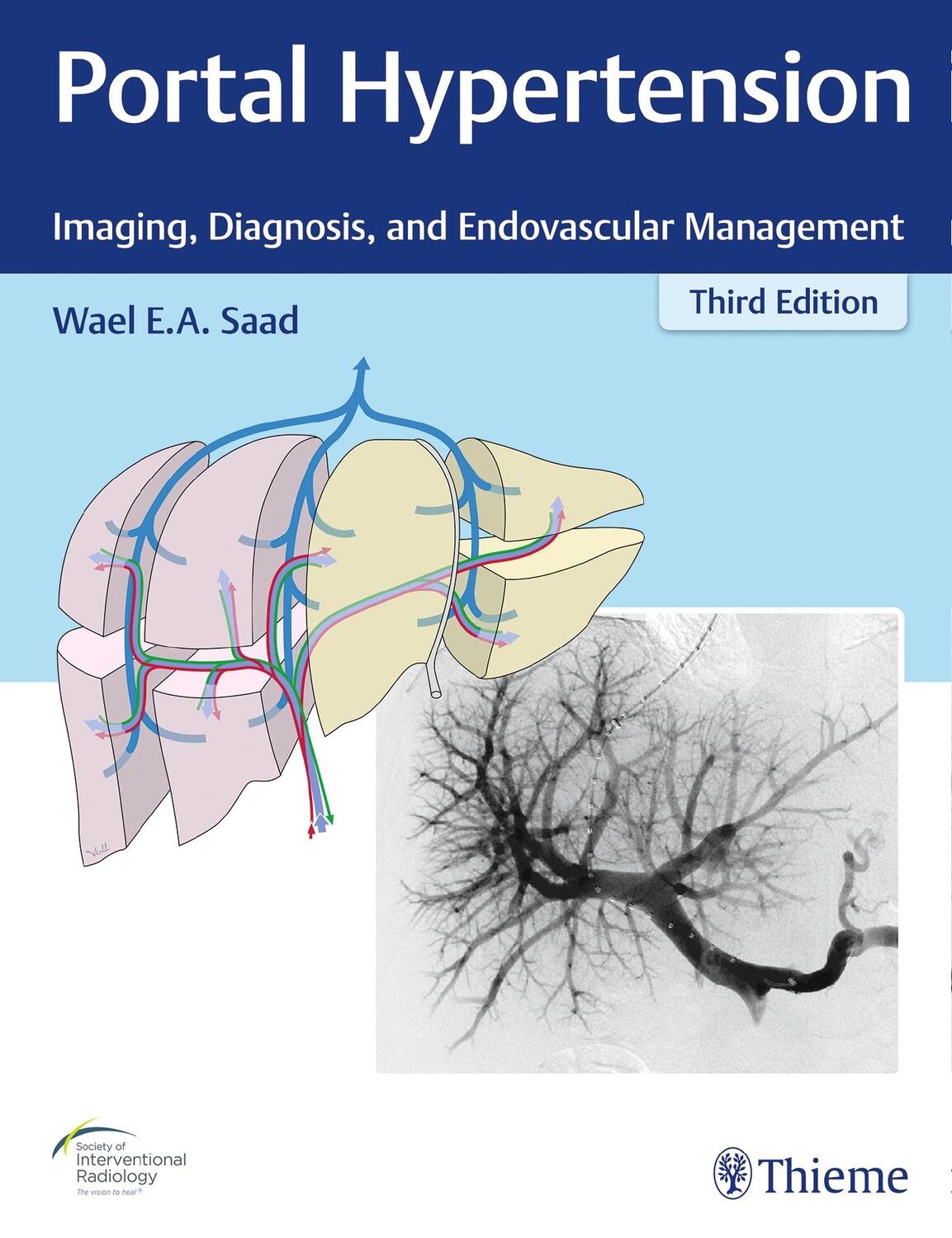 Cover: 9781626233270 | Portal Hypertension | Imaging, Diagnosis, and Endovascular Management