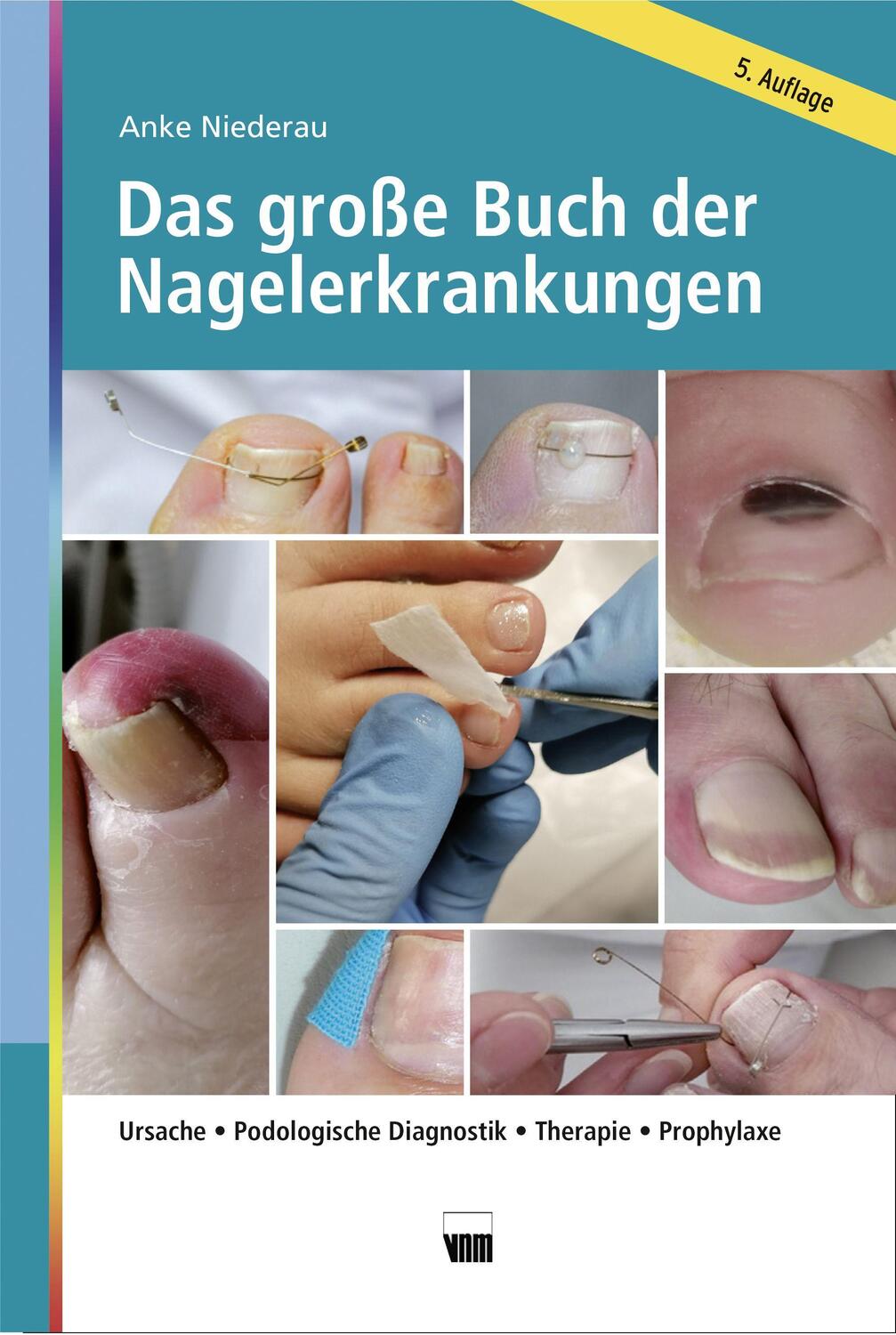 Cover: 9783954090730 | Das große Buch der Nagelerkrankungen | Anke Niederau | Buch | Deutsch