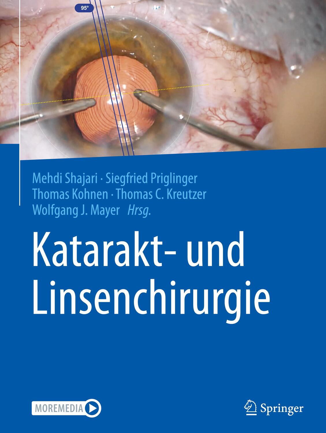 Cover: 9783662624579 | Katarakt- und Linsenchirurgie | Mehdi Shajari (u. a.) | Buch | Deutsch