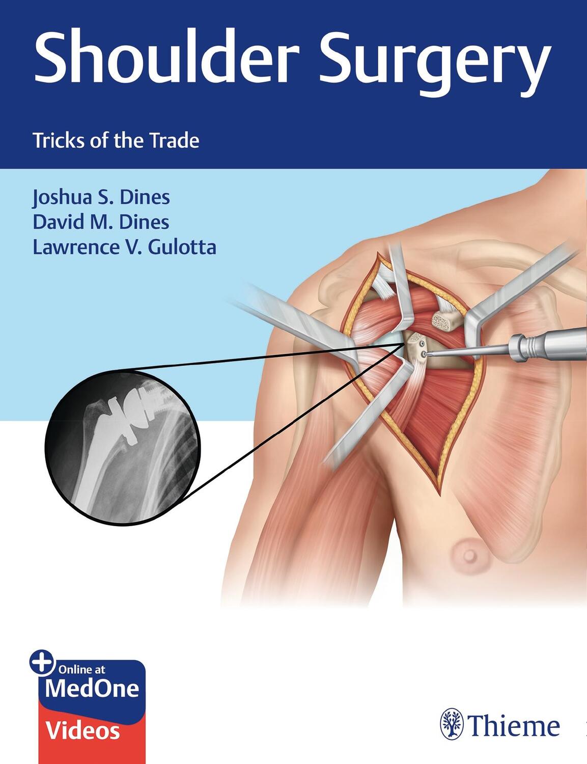 Cover: 9781626235168 | Shoulder Surgery | Tricks of the Trade | Joshua Dines (u. a.) | Bundle