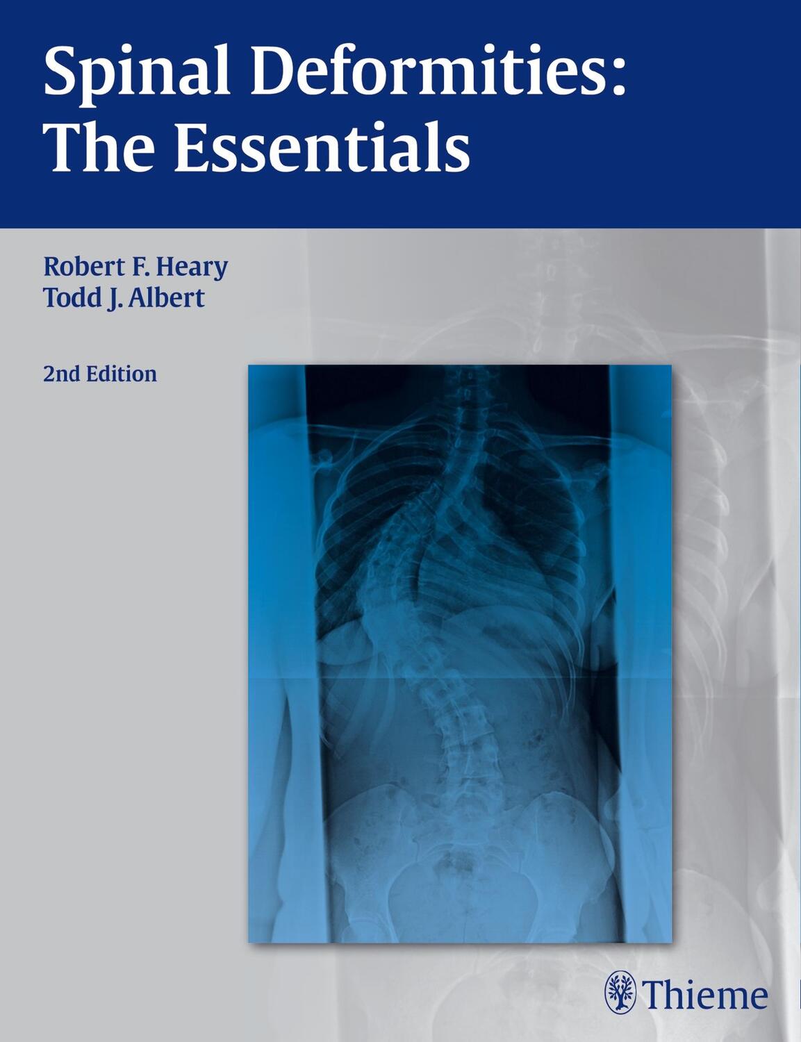 Cover: 9781604064117 | Spinal Deformities: The Essentials | Robert F. Heary (u. a.) | Buch