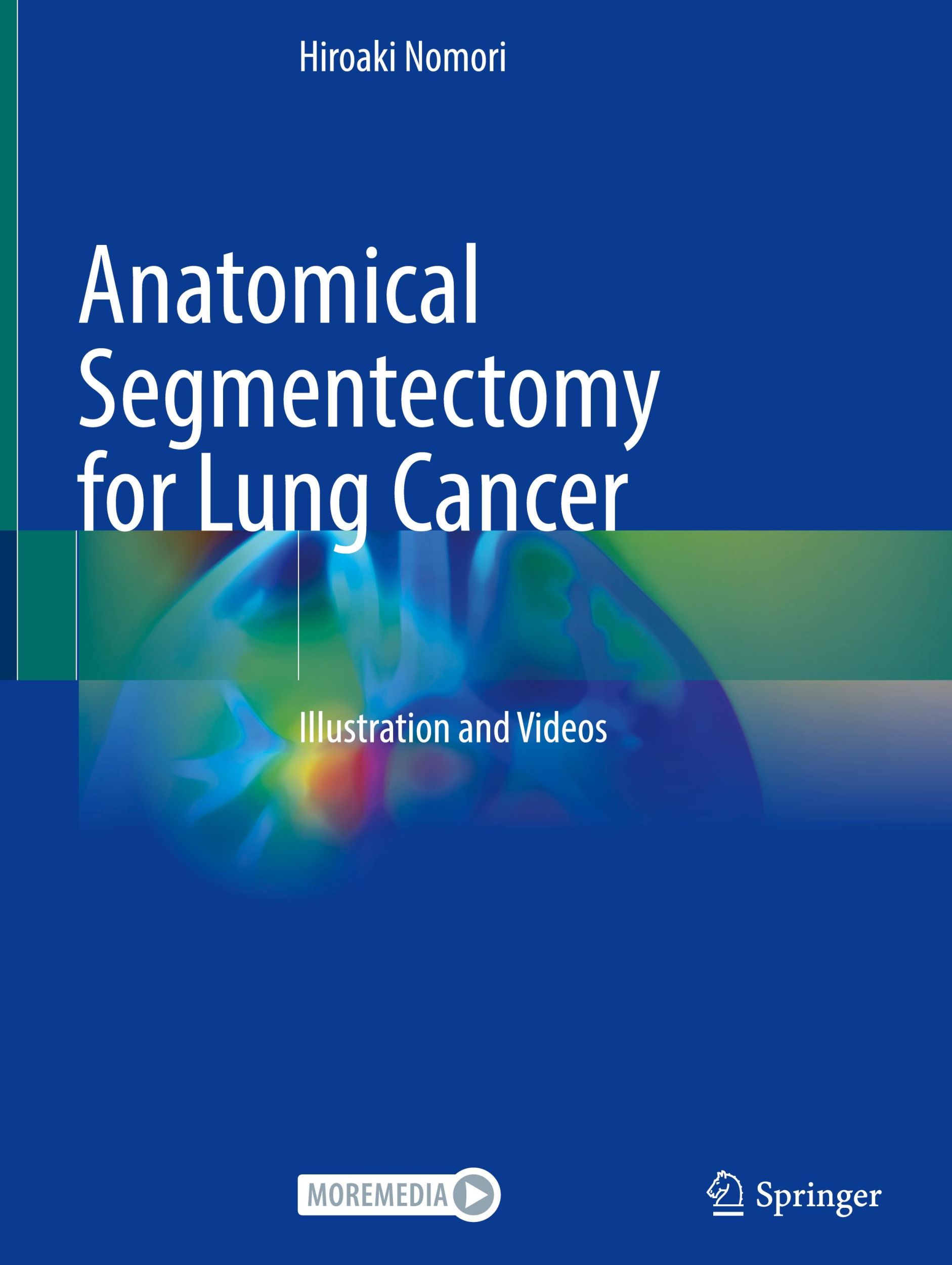 Cover: 9789819958566 | Anatomical Segmentectomy for Lung Cancer | Illustration and Videos | x