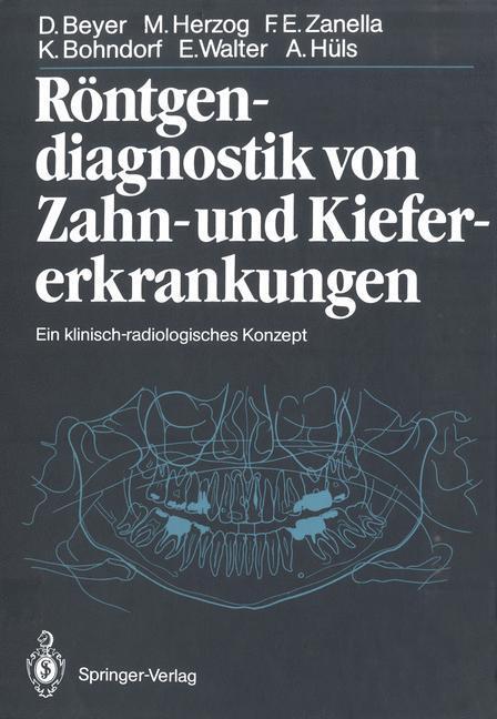 Cover: 9783642710643 | Röntgendiagnostik von Zahn- und Kiefererkrankungen | Beyer (u. a.)